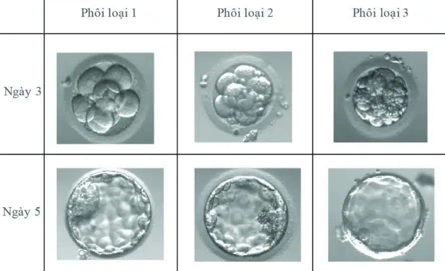 Phân loại phôi ngày 3-5