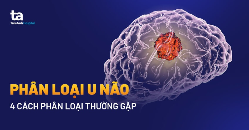 Phân loại u não