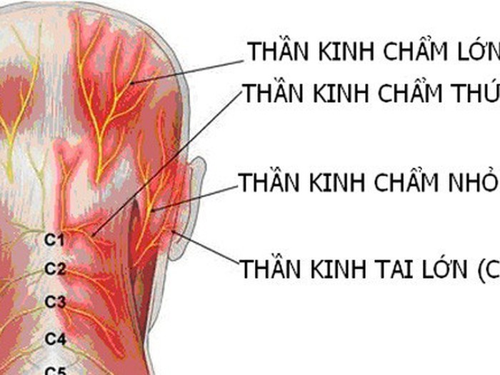 Chẩn đoán đau dây thần kinh bằng MRI