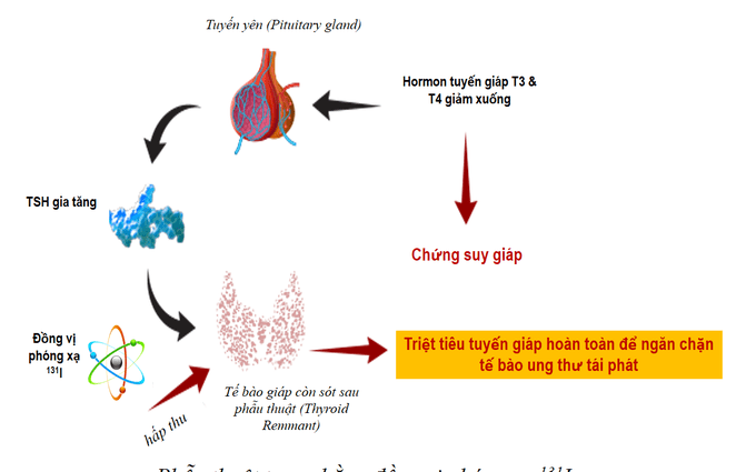 Suy giáp sau xạ trị iod: Hiểu đúng để điều trị hiệu quả 8 Triệu chứng suy giáp