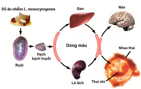 Con đường xâm nhập của Listeria vào thai nhi