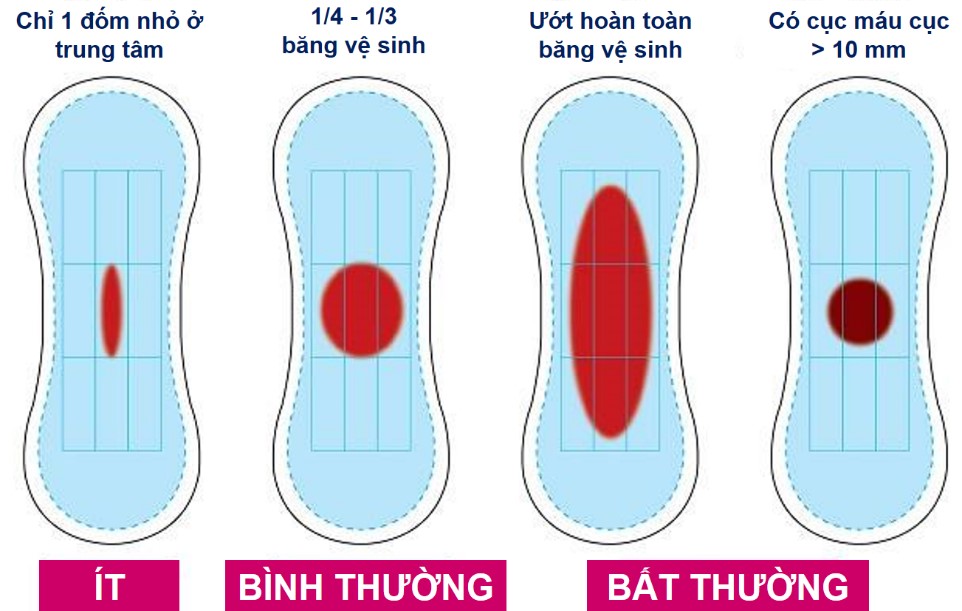 Ra huyết bất thường do bệnh lý thực thể
