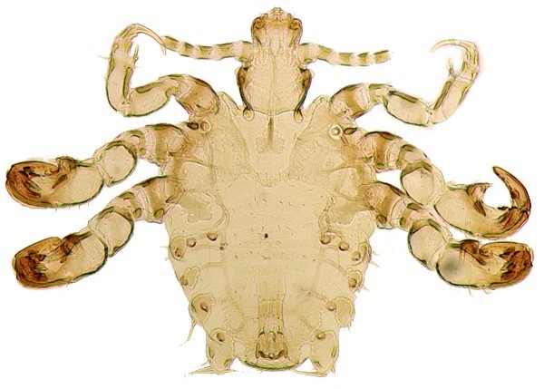 Triệu chứng rận mu