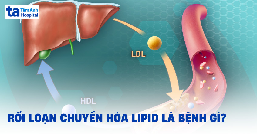 Biểu hiện lâm sàng của rối loạn chuyển hóa lipid