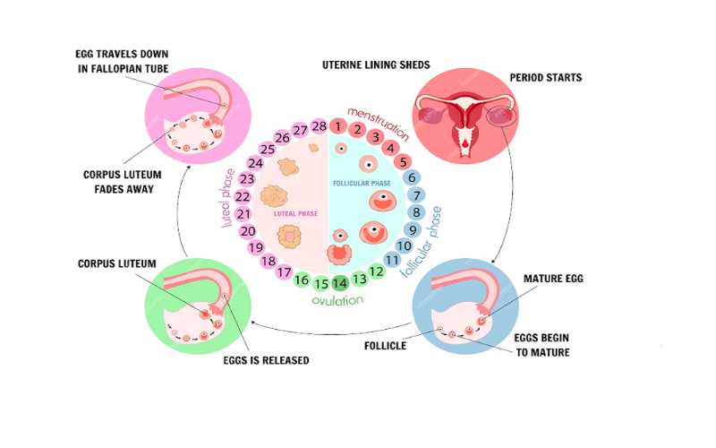 Siêu âm buồng trứng đa nang ở phụ nữ PCOS