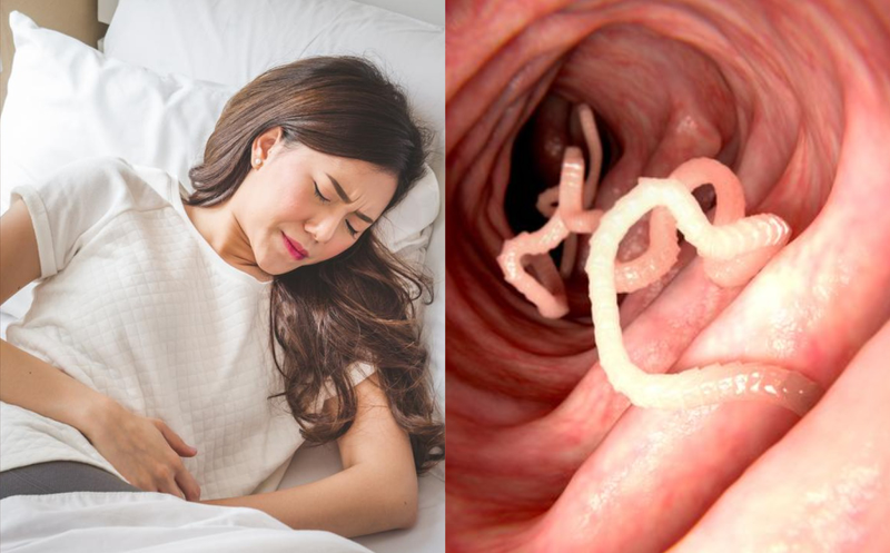 Hình ảnh sán dây cá Diphyllobothrium latum