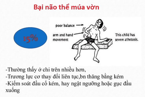 Hình ảnh tổn thương não trong bại não thể múa vờn