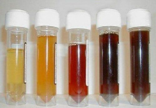 Triệu chứng bệnh porphyrin da