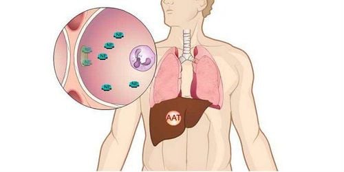 Tổn thương phổi do thiếu hụt Alpha-1 antitrypsin