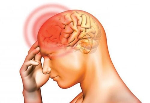 Viêm màng não nước trong