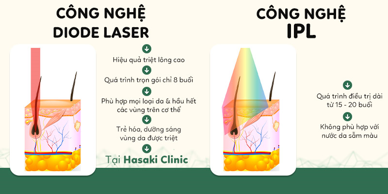 so sánh IPL và Diode Laser