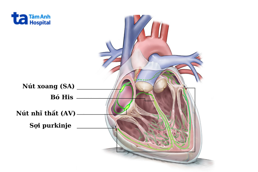 Suy nút xoang là rối loạn nhịp xuất phát từ nút xoang