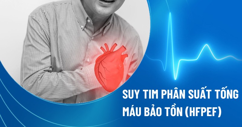 Hình ảnh minh họa suy tim phải