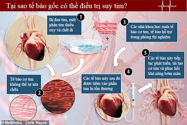Triệu chứng bệnh cơ tim do hóa trị