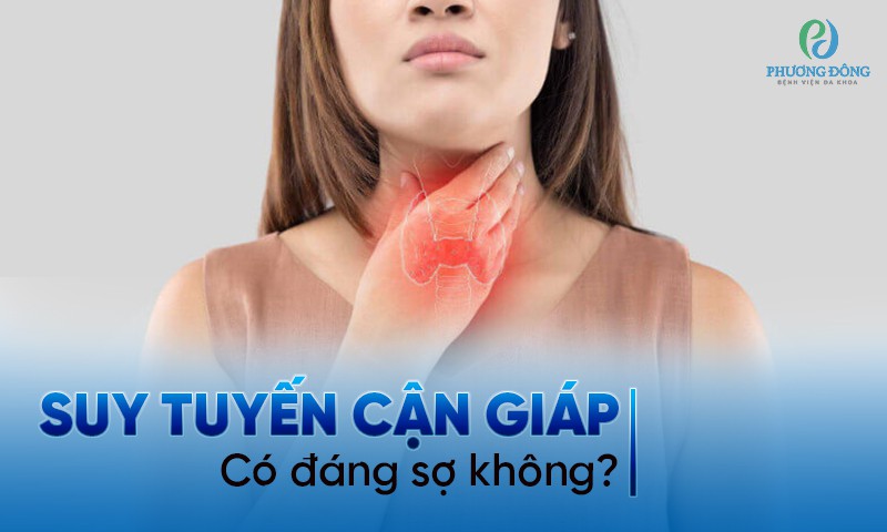 Suy cận giáp: Nguyên nhân, triệu chứng, chẩn đoán và điều trị toàn diện 8 Triệu chứng suy cận giáp