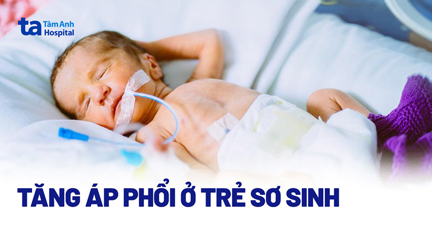 Tăng áp phổi tồn tại ở trẻ sơ sinh