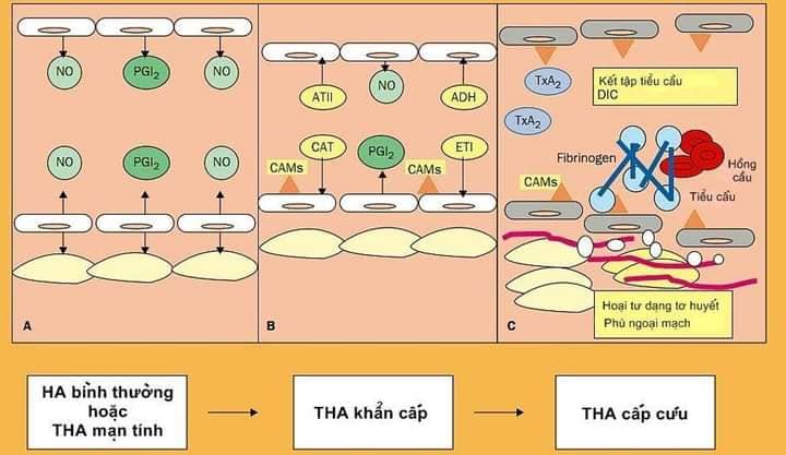 Cơn tăng huyết áp khẩn cấp: Nhận diện, nguyên nhân và xử trí đúng cách 8 Biến chứng của tăng huyết áp khẩn cấp