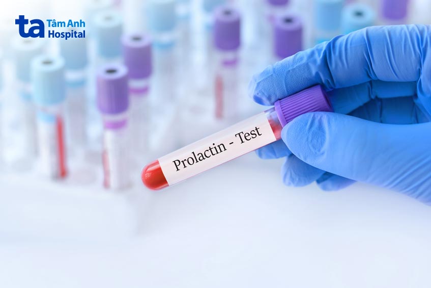 Tăng Prolactin Máu: Triệu Chứng, Nguyên Nhân Và Cách Điều Trị Từ Chuyên Gia 7 Tăng prolactin máu là tình trạng dư thừa prolactin trong máu