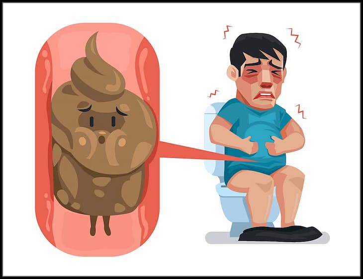 Hình ảnh minh họa táo bón ở người lớn