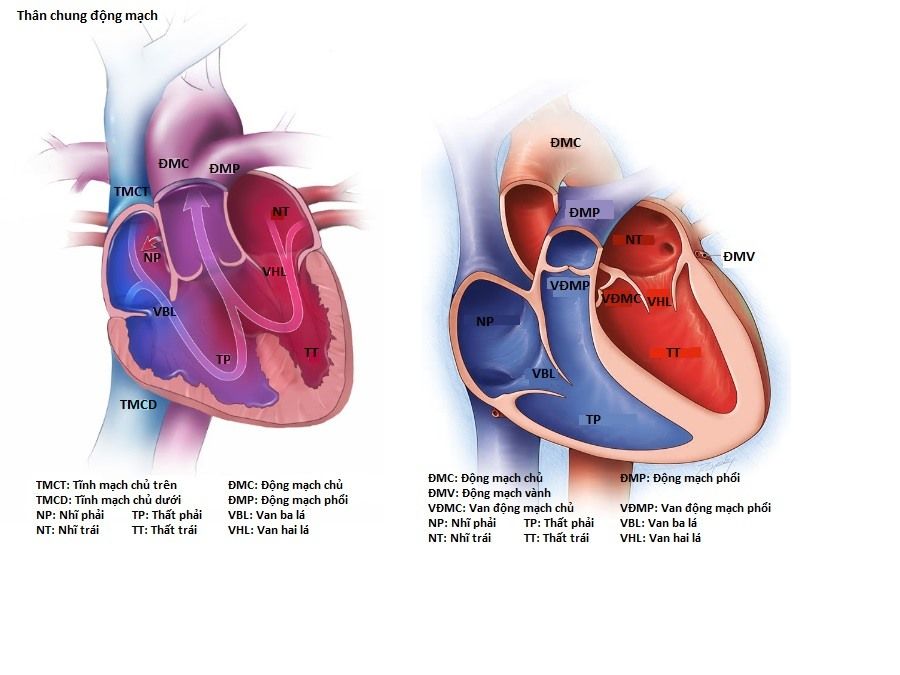 Hình ảnh mô phỏng thân chung động mạch