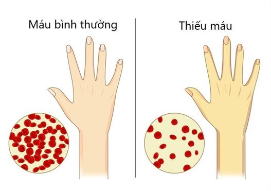 Thực phẩm giàu vitamin B12