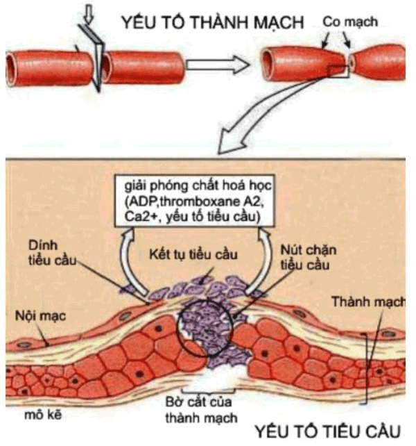 Minh họa thiếu yếu tố V trong máu