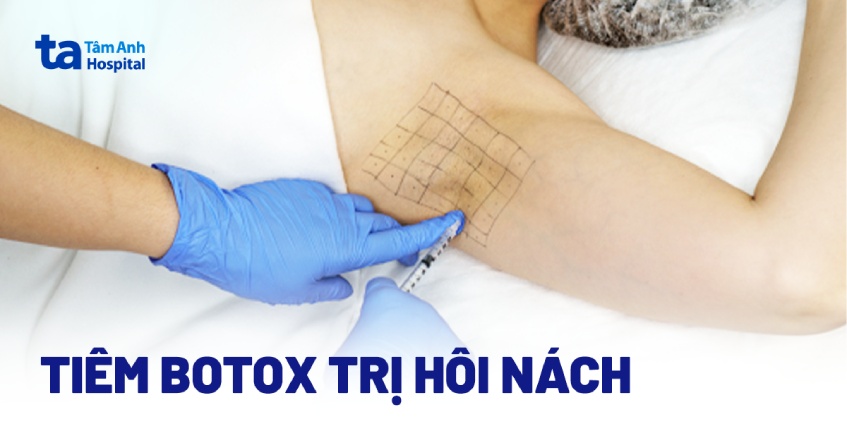 triệu chứng tăng tiết mồ hôi