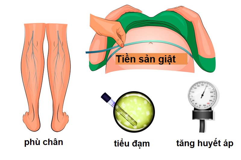 Sản giật: Biến chứng nguy hiểm đe dọa tính mạng thai phụ 8 điều trị sản giật trong bệnh viện