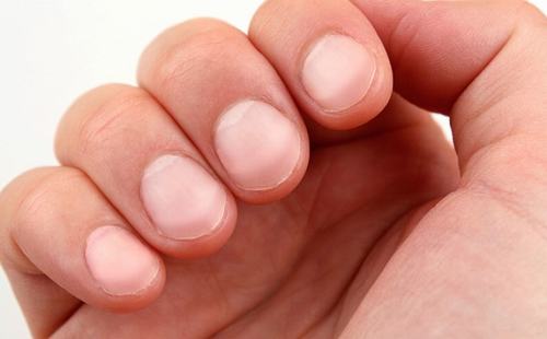Nguyên nhân phổi gây ngón tay dùi trống
