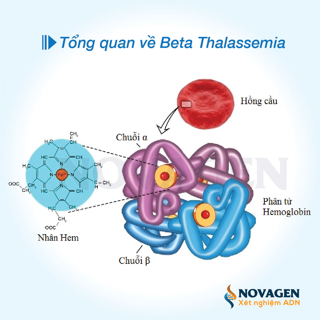 Tổng quan về bệnh Thalassemia Beta