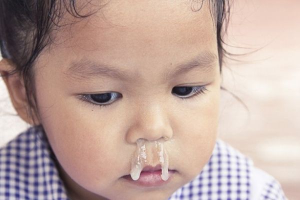 Trẻ em dễ bị sổ mũi do hệ miễn dịch chưa hoàn thiện