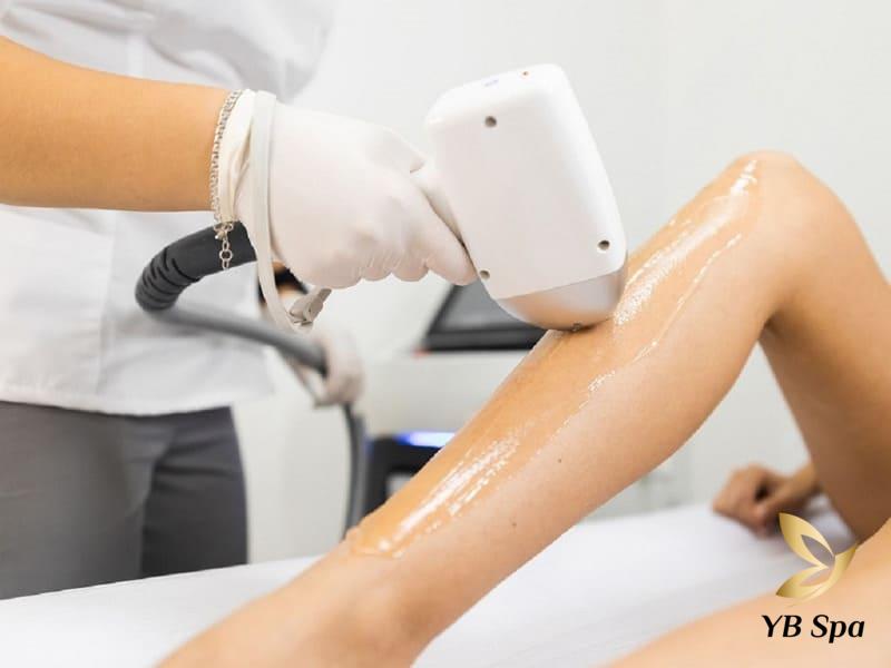 Triệt lông an toàn hiệu quả