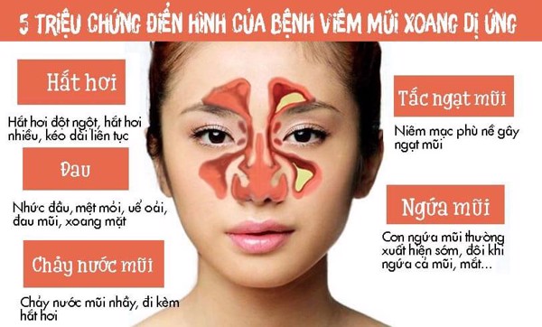 Viêm mũi dị ứng nghề nghiệp: Nguy cơ tiềm ẩn từ môi trường làm việc 3 Triệu chứng của viêm mũi dị ứng