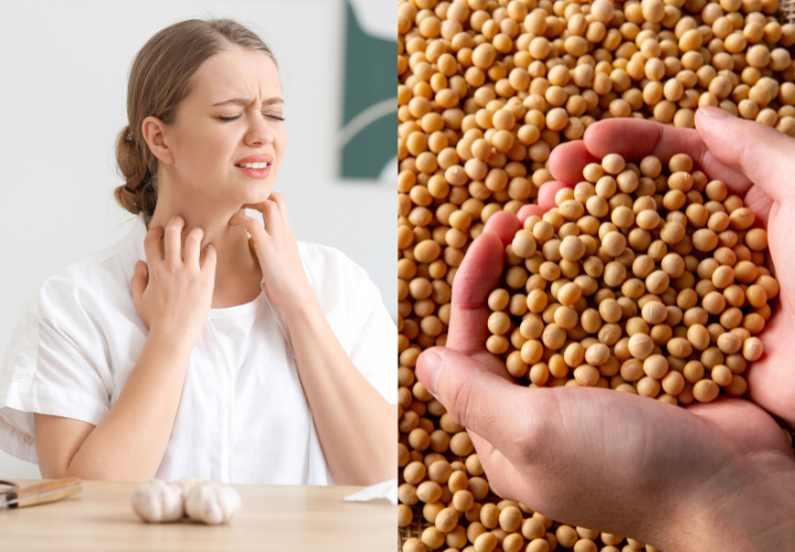 Triệu chứng dị ứng đậu nành