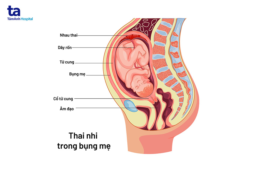 Tử cung bị vỡ khi sinh