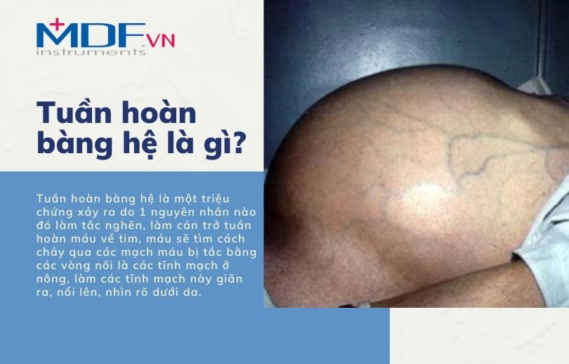 tuần hoàn bàng hệ là gì