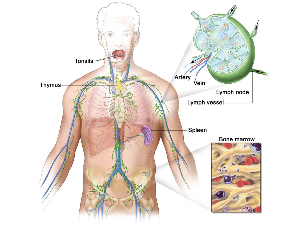 U lympho hệ thần kinh trung ương