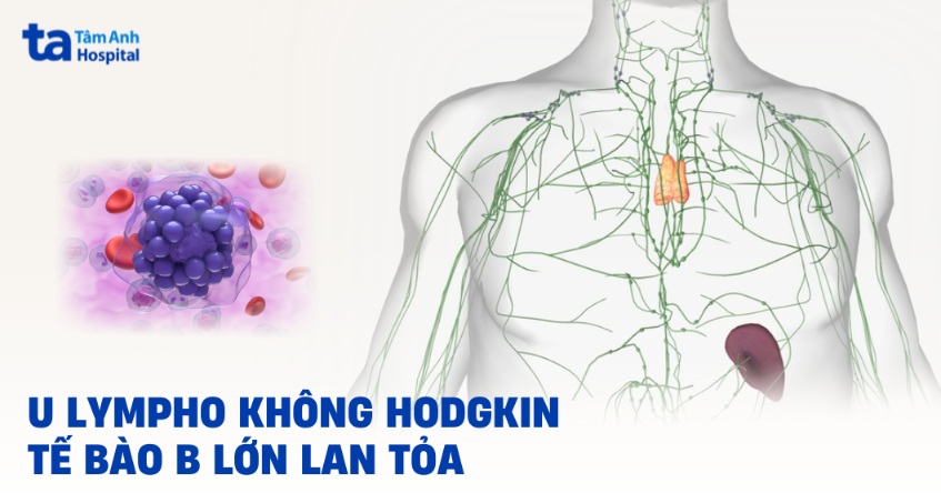 Phân tích hình ảnh tế bào B lớn dưới kính hiển vi