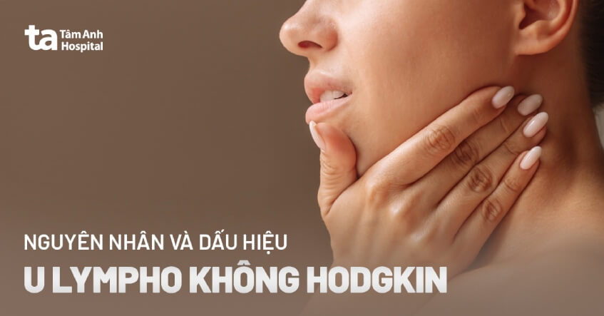 Phác đồ điều trị u lympho không Hodgkin