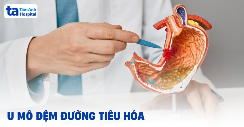 Triệu chứng GISTs