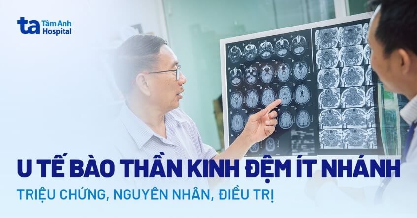 u tế bào thần kinh đệm ít nhánh
