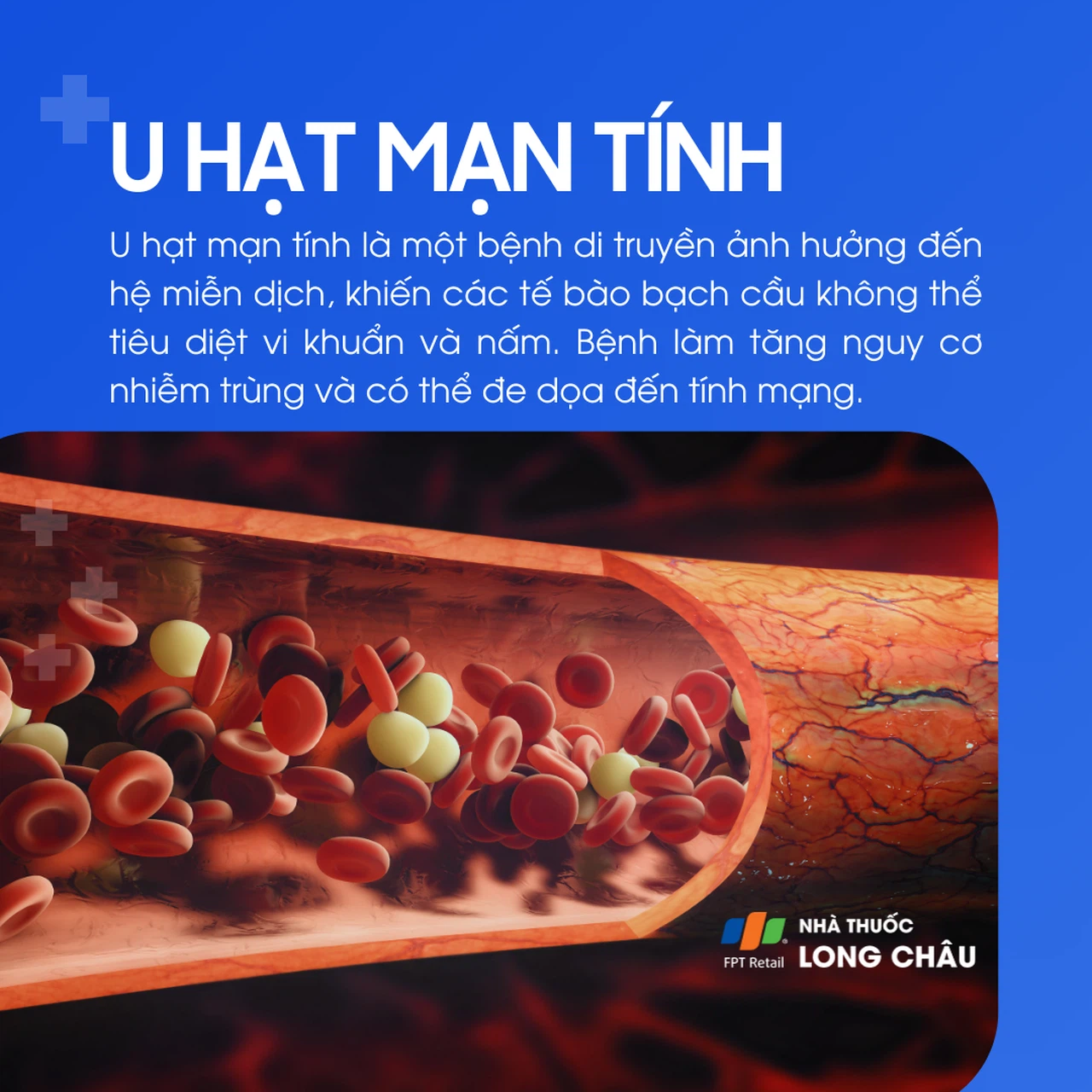 Bệnh u hạt mạn tính: Triệu chứng, nguyên nhân và phương pháp điều trị hiệu quả 6 Hình ảnh u hạt ở phổi