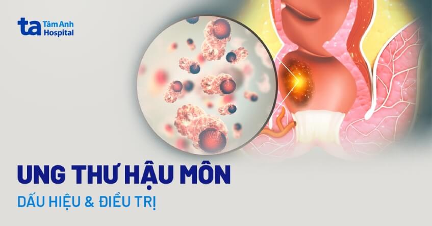 Các biểu hiện bên ngoài dễ thấy của ung thư ống hậu môn