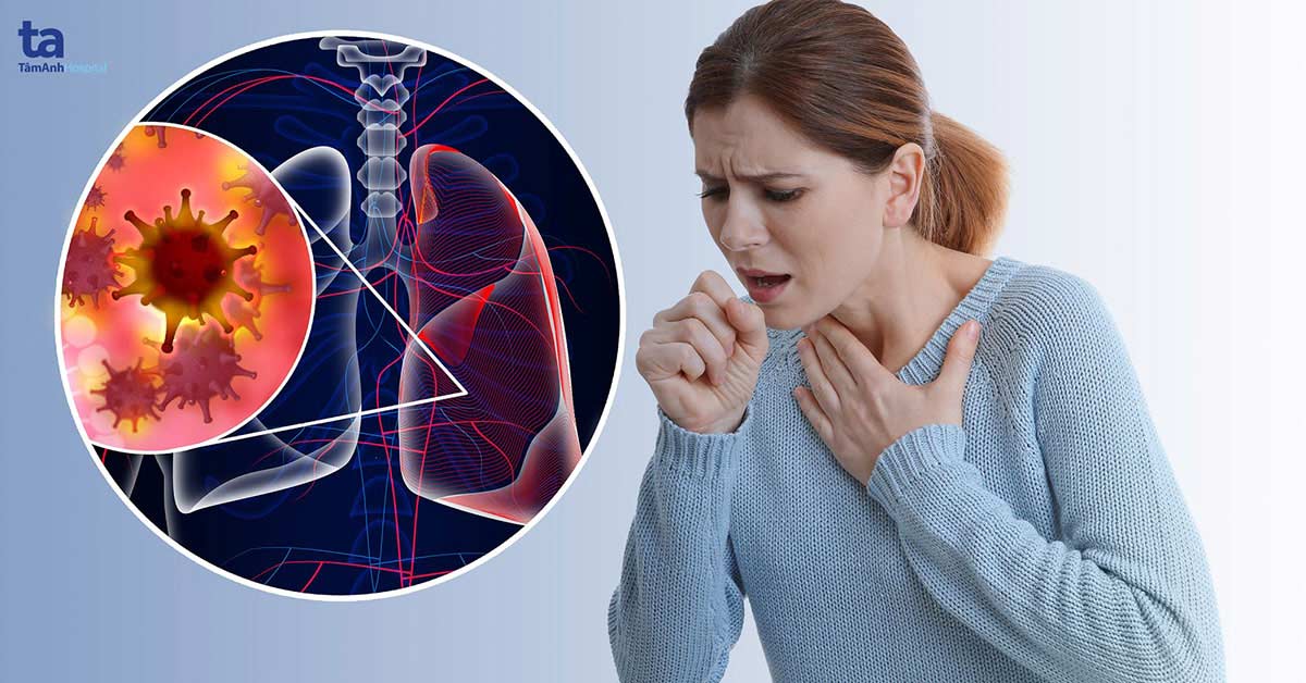 Phim chụp ung thư phổi qua CT scan