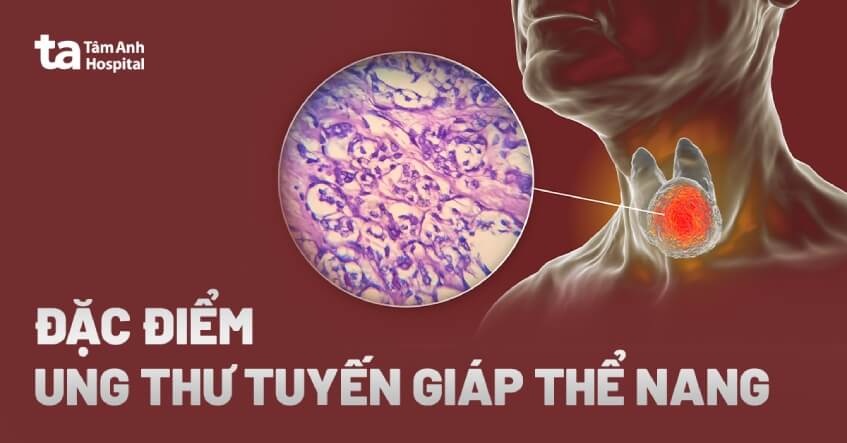 Ung thư tuyến giáp dạng nang