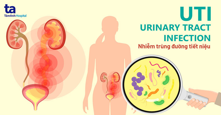 Nhiễm trùng đường tiết niệu (UTI): Nguyên nhân, triệu chứng và cách điều trị hiệu quả 8 Hệ thống tiết niệu người