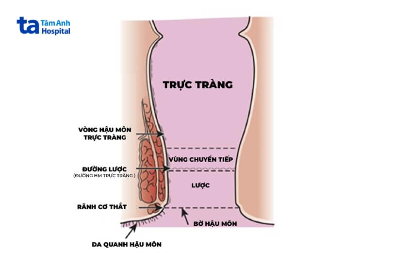 Vị trí phát triển ung thư hậu môn