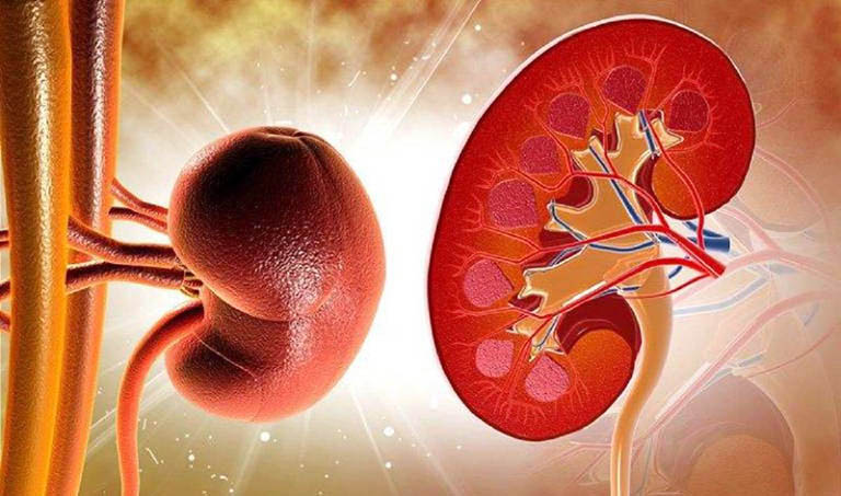 Hình ảnh trẻ em bị phù do viêm cầu thận cấp