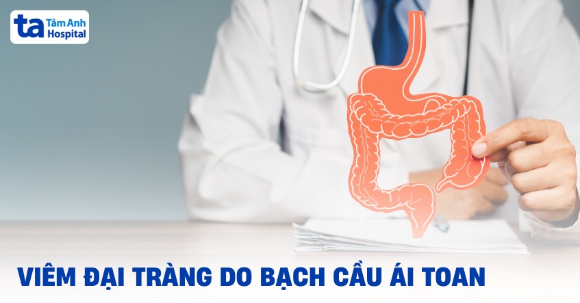 Viêm đại tràng tăng bạch cầu ái toan: Bệnh lý hiếm gặp dễ bị bỏ sót trong chẩn đoán 7 Hình ảnh minh họa viêm đại tràng do bạch cầu ái toan