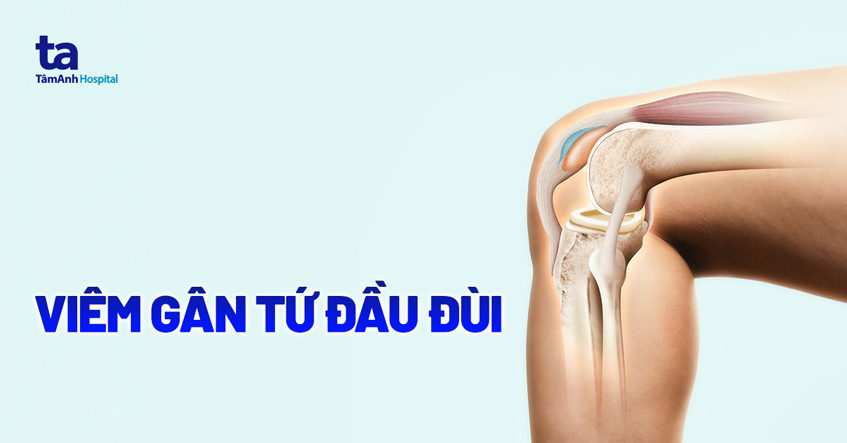 viêm gân tứ đầu đùi